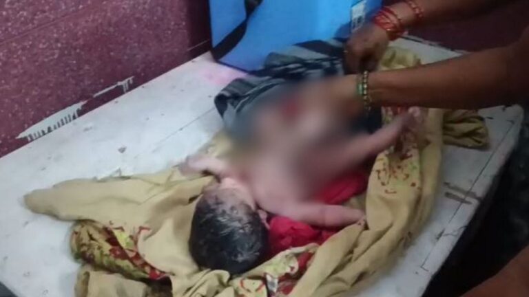 मध्य प्रदेश के छतरपुर में चार हाथ-चार पैरों वाले बच्चे के जन्म का रहस्य: डॉक्टरों ने बताया कारण मध्य प्रदेश के छतरपुर में चार हाथ-चार पैरों वाले बच्चे के जन्म का रहस्य: डॉक्टरों ने बताया कारण